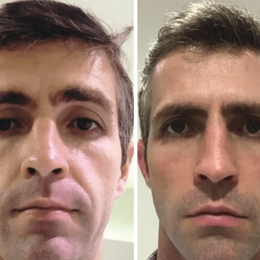 Collagen Fit - Máscara de Colagénio - Comprar em Bello Sconto