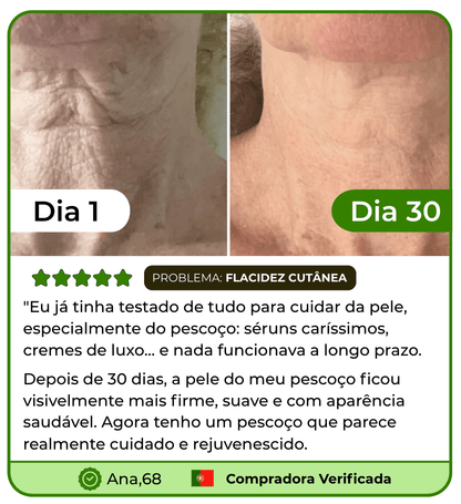 LIFT SKIN - Massageador Facial para rosto e pescoço Efeito Lifting Anti - Rugas - Comprar em Bello Sconto