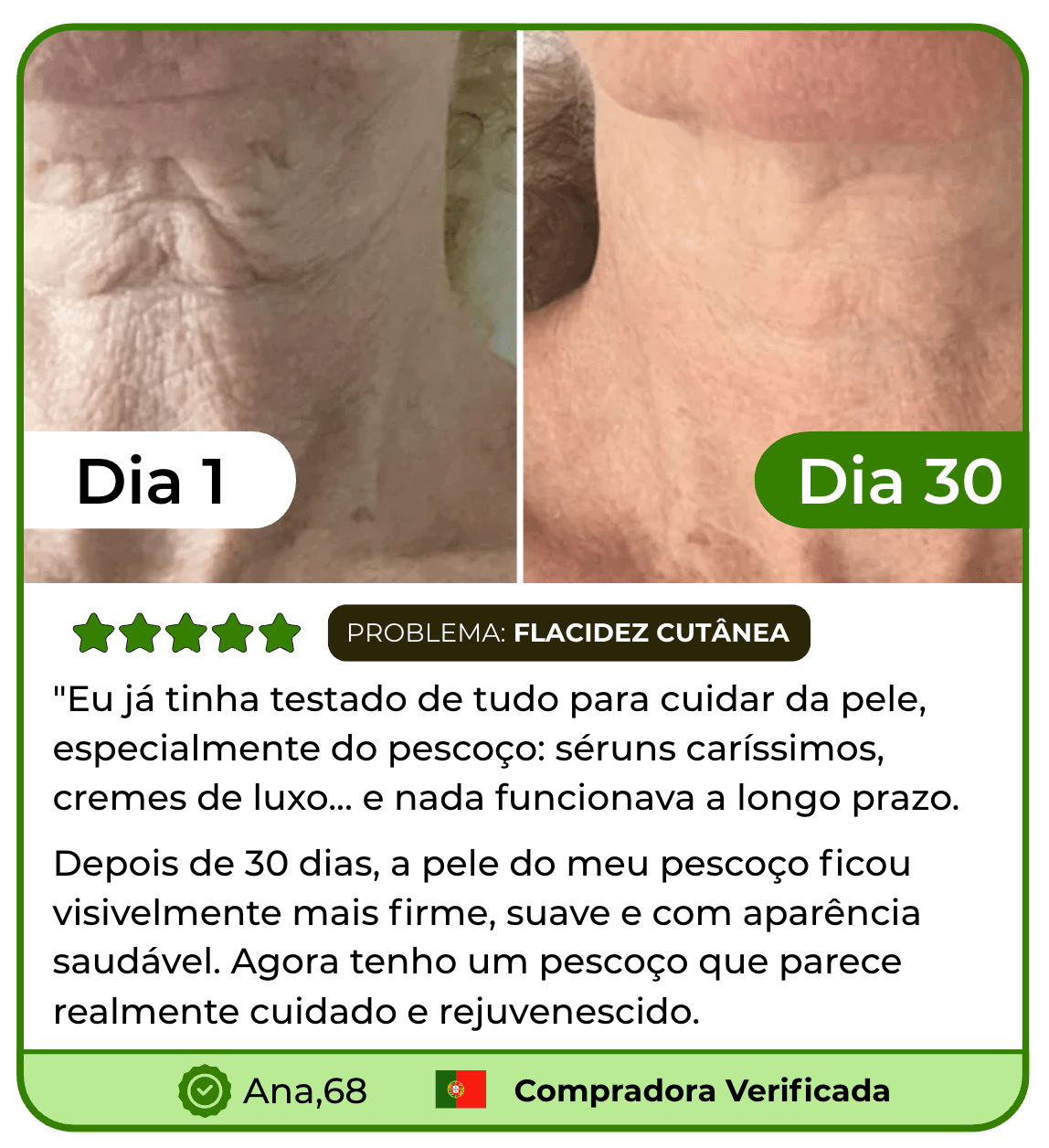 LIFT SKIN - Massageador Facial para rosto e pescoço Efeito Lifting Anti - Rugas - Comprar em Bello Sconto