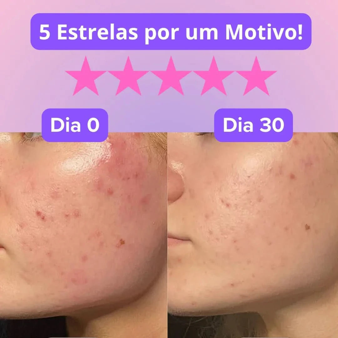 Máscara Rejuvenescedora efeito anti - rugas - LUMY - Comprar em Bello Sconto